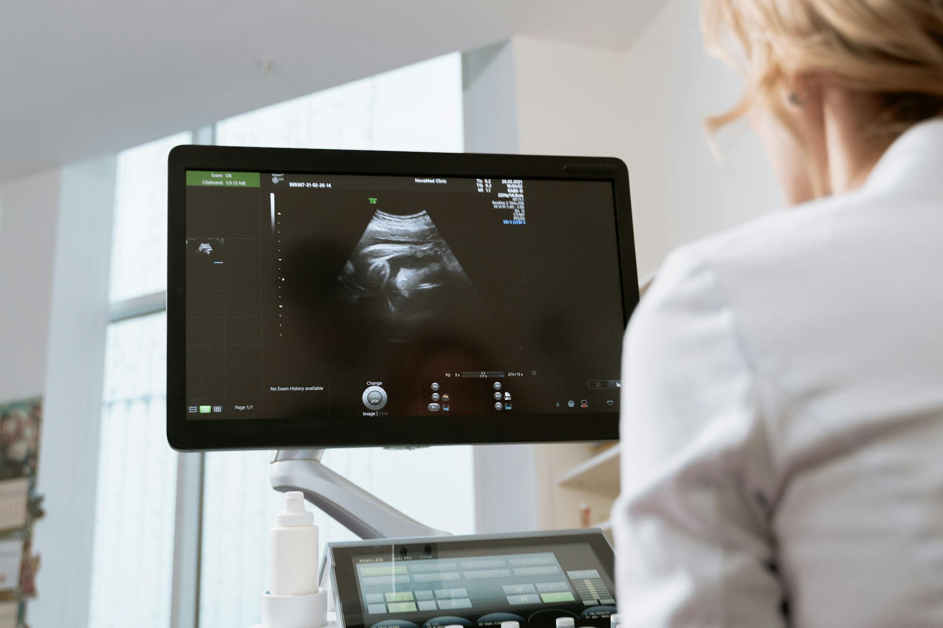 Kombinacija ultrazvuka i mamografije za najbolje rezultate raznih bolesti dojke